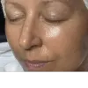 TheFacialTherapist